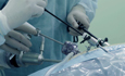 What are the types of cancers that can be treated with laparoscopic surgery?