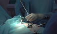 What is laparoscopic cancer surgery and how does it work?