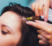 PRP For Hair Growth